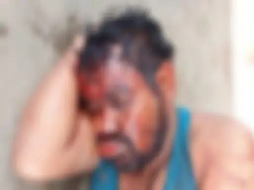 एक झपकी और हो गया हादसा: पत्नी से विवाद के बाद रायपुर से शहडोल जा रहा था युवक… चलती ट्रेन से गिर कर हो गया घायल… समपार फाटक के पास जख्मी हालत में मिला